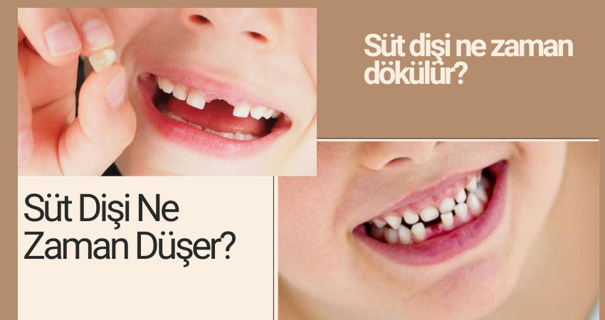 Süt Dişi Ne Zaman Düşer? İzmir 
