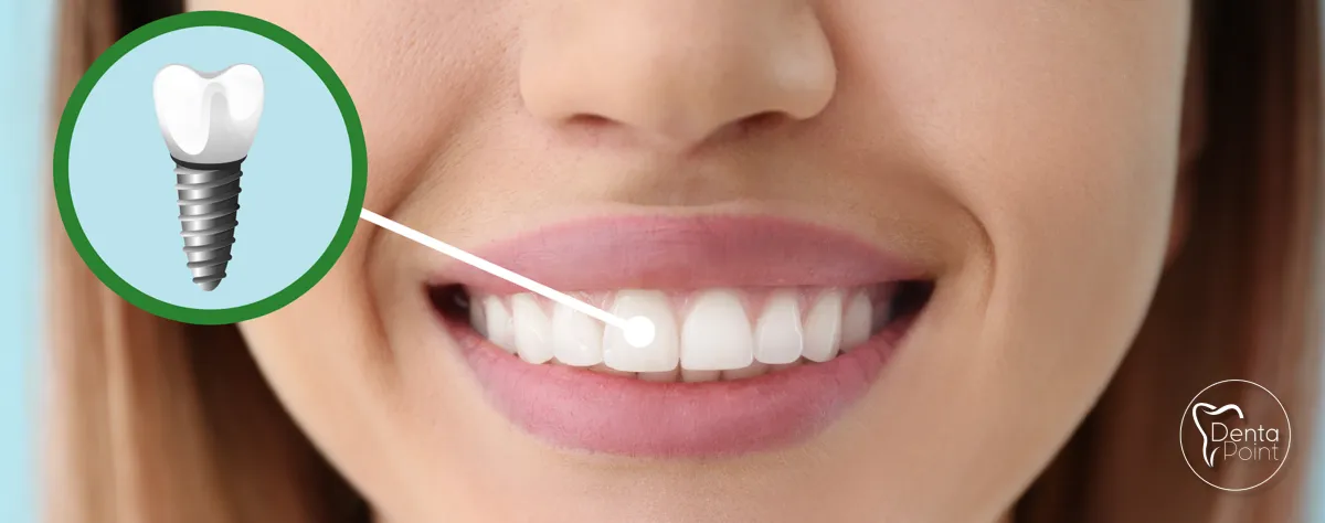 Dental implant İzmir